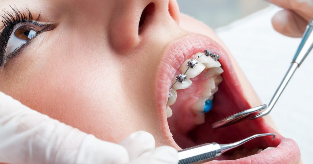 Ortodoncia pacientes con FONASA